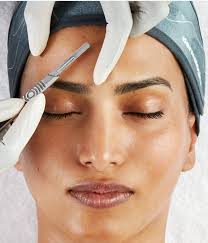 Erase Esthetics Laser Hair Removal - Dermaplaning Add On