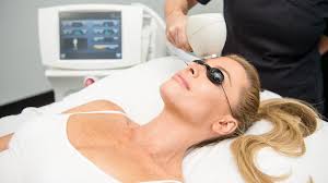 Erase Esthetics Photofacials/Skin Rejuvenation